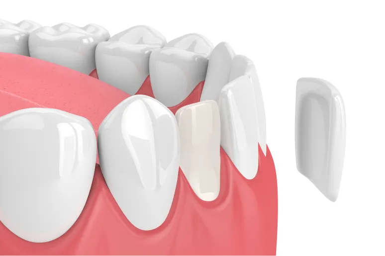 Braces treatment visualization