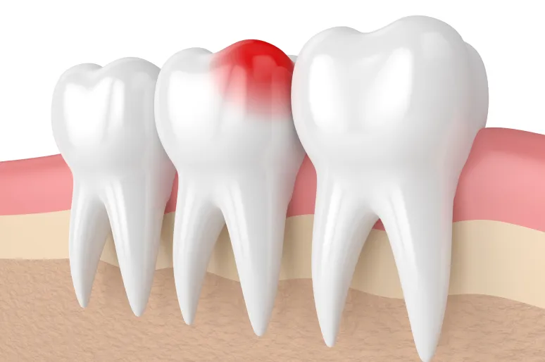 Toothache and emergency dentistry treatment visualization